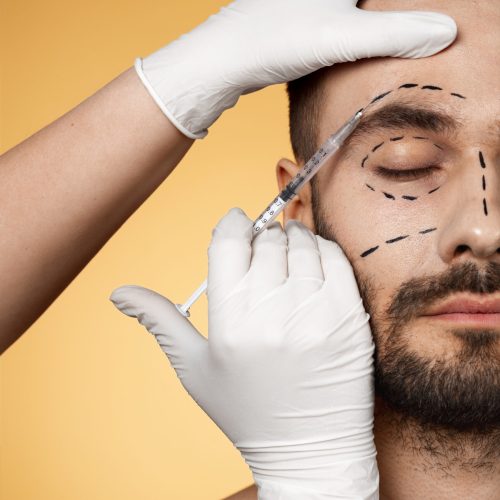 PRP (Facial Rejuvenation)