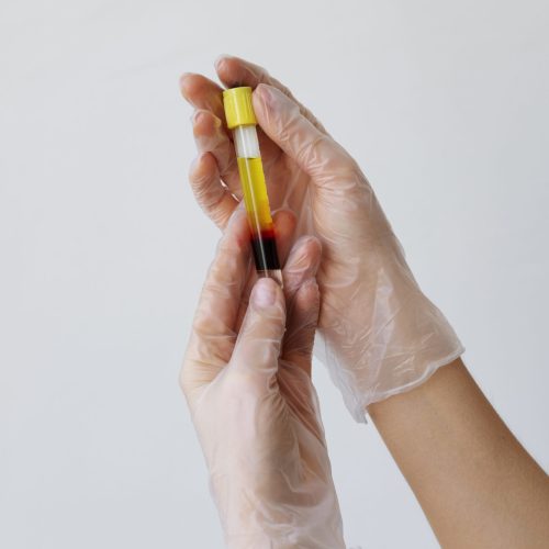Vitamin IV Therapy
